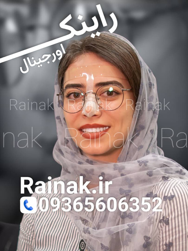 هولدر عینک بعد از عمل بینی راینک glass